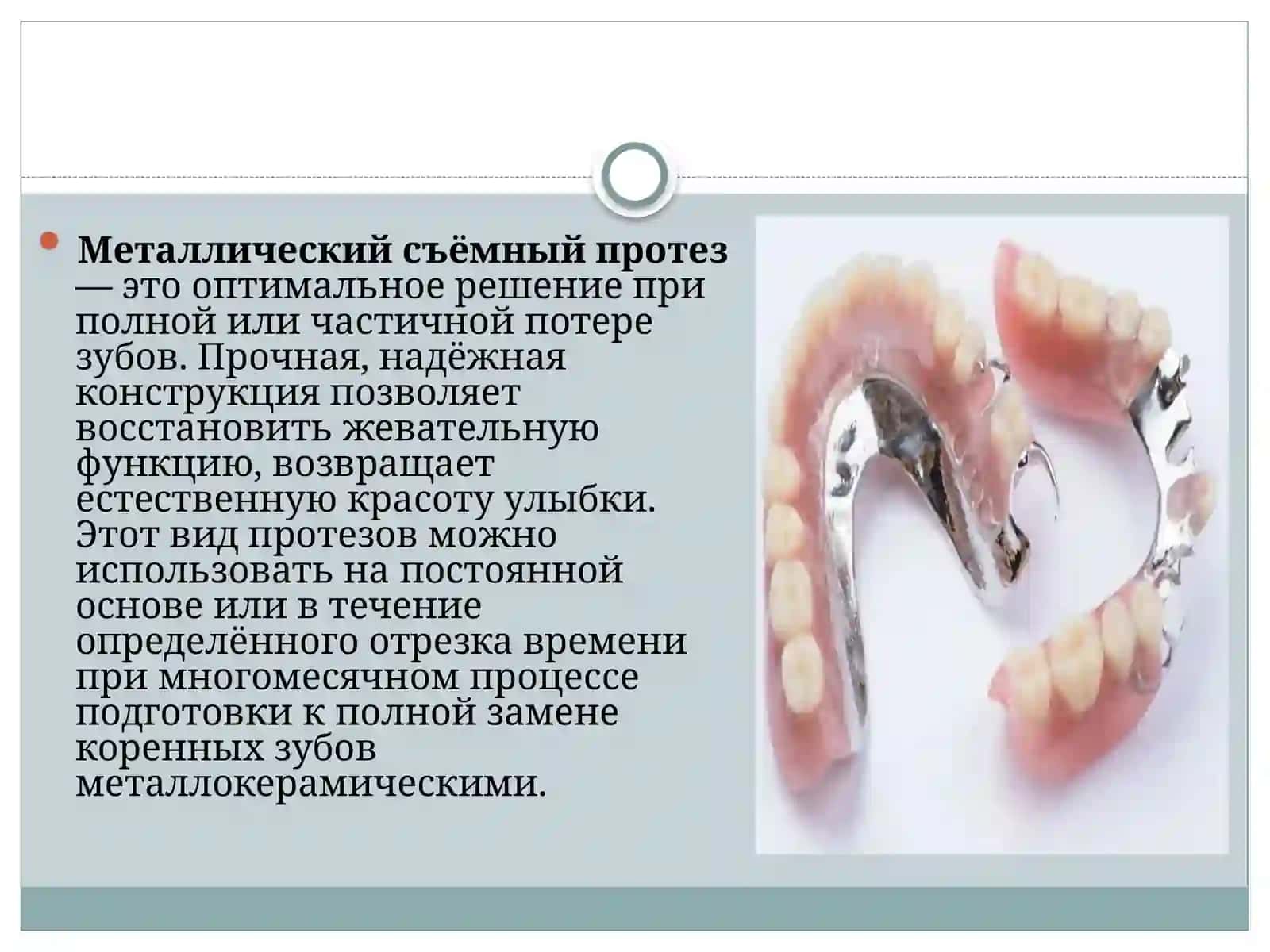 Cъемныепротезы с металлическим базисом 2