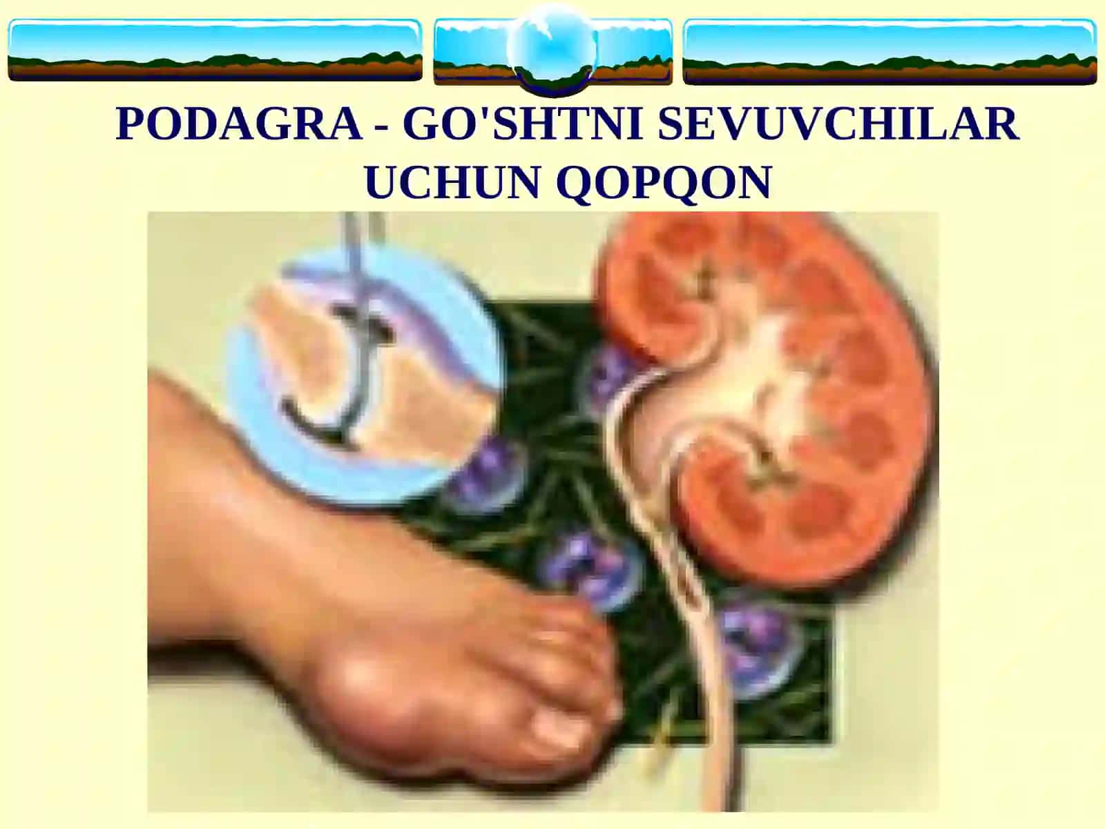 PODAGRA 2