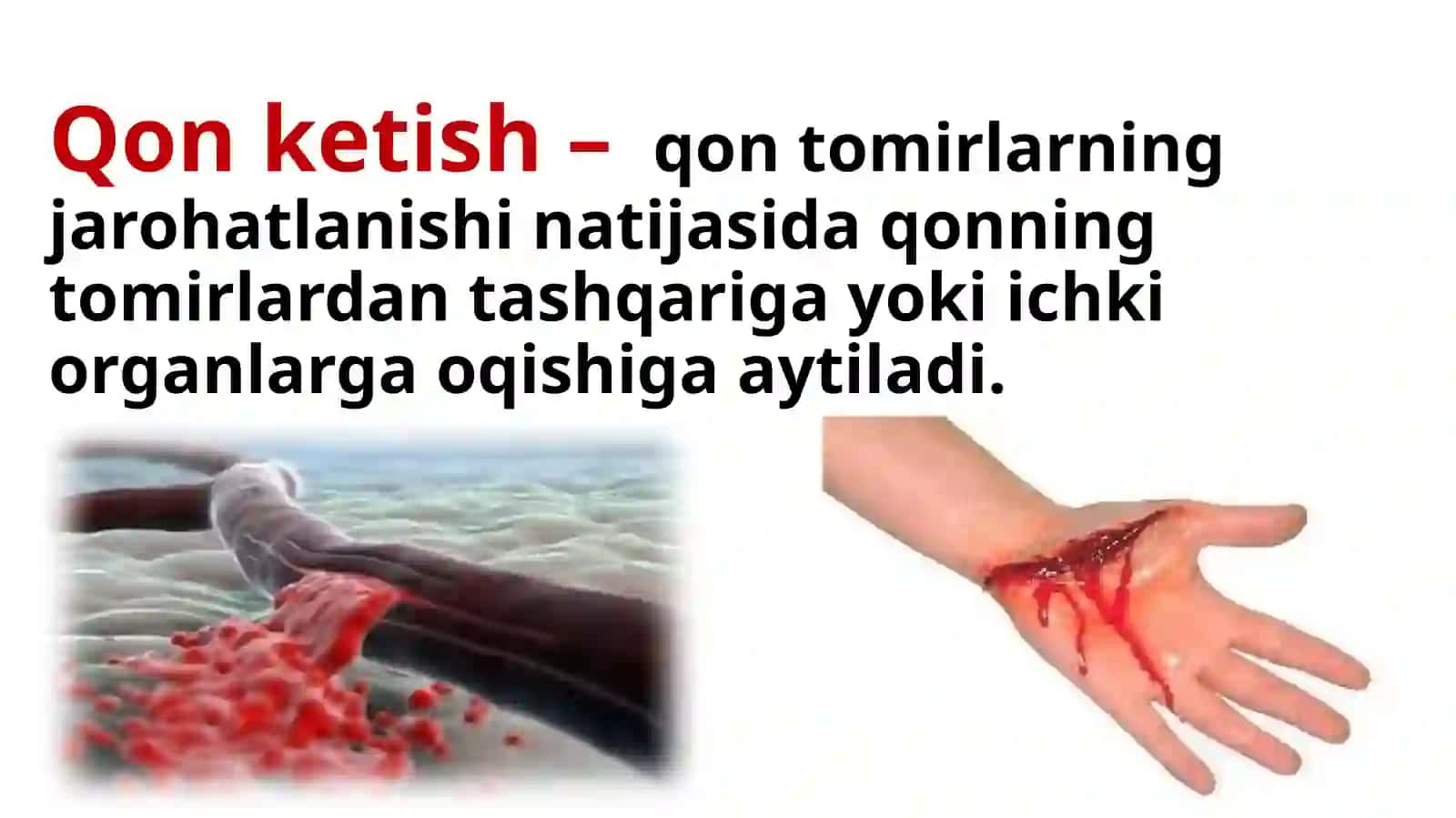 1-IDUM biologiya o’qituvchisi Turdaliyeva Dilfuzaning “Tomirlardan qon ketganda birinchi yordam ko’rsatish”mavzusidagi dars taqdimoti 2