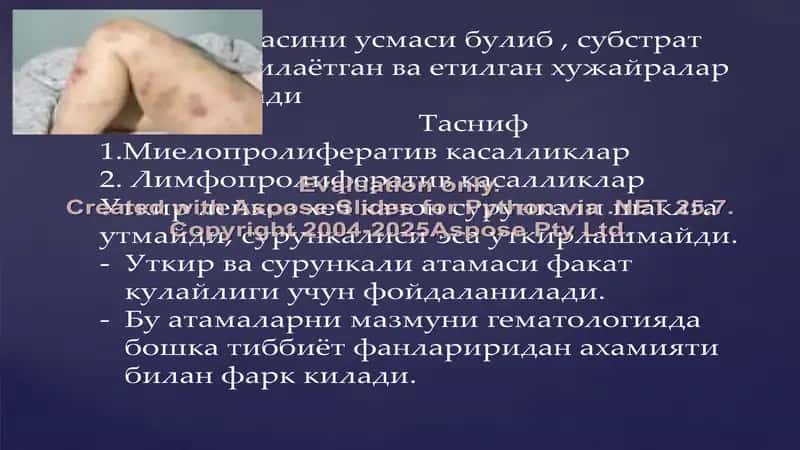 Сурункали лейкозлар 2