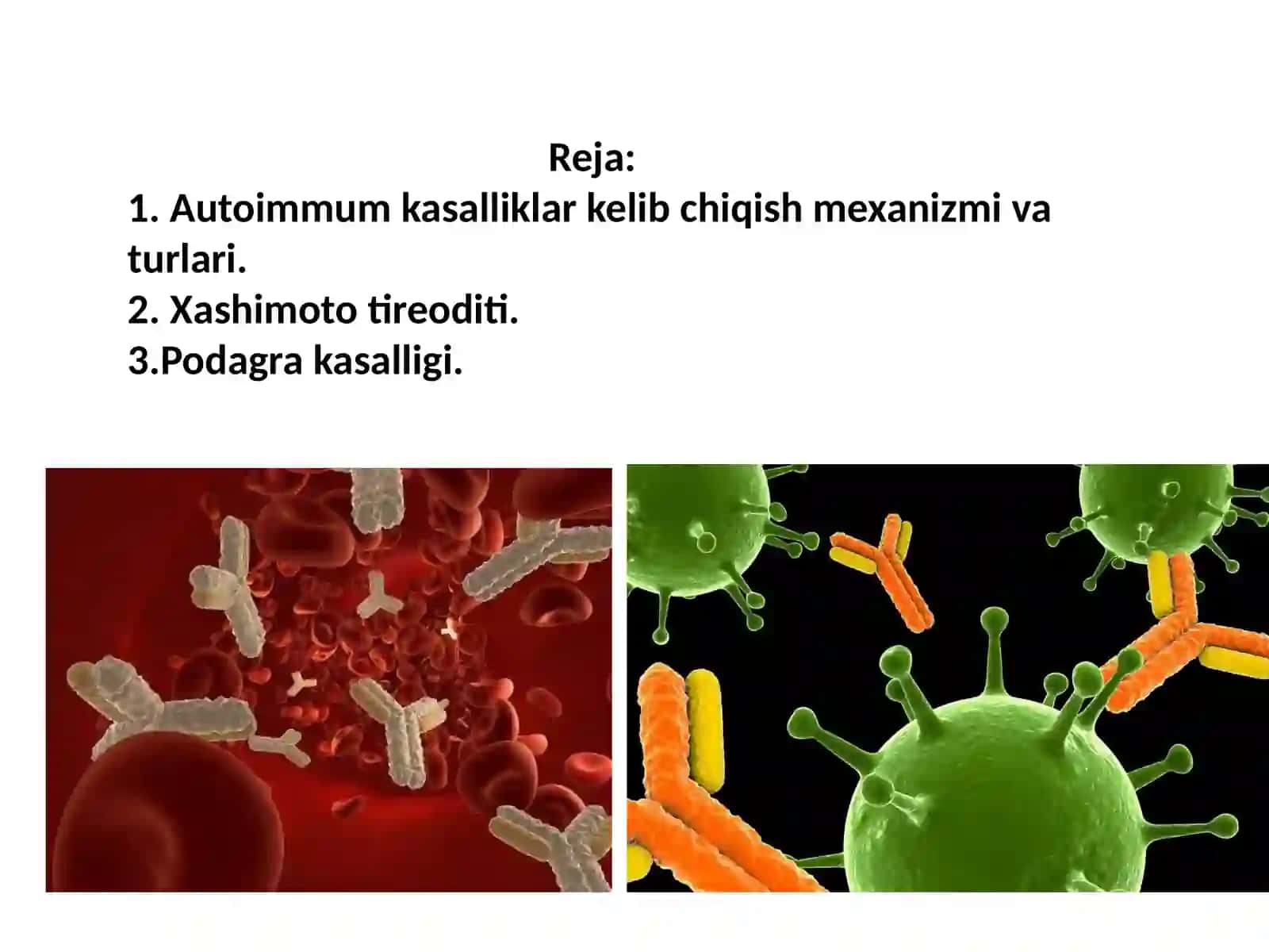 Autoimmun kasalliklaridiagnostikasi 2