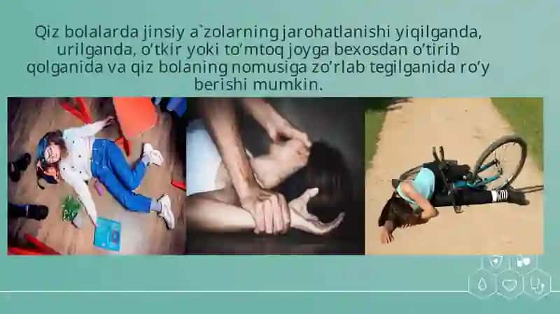 QIZ BOLALARDA JINSIY A’ZOLARNING JAROHATLARI. JAROHATLARDA BIRINCHI SHIFOKOR YORDAMINI KO’RSATISH 2