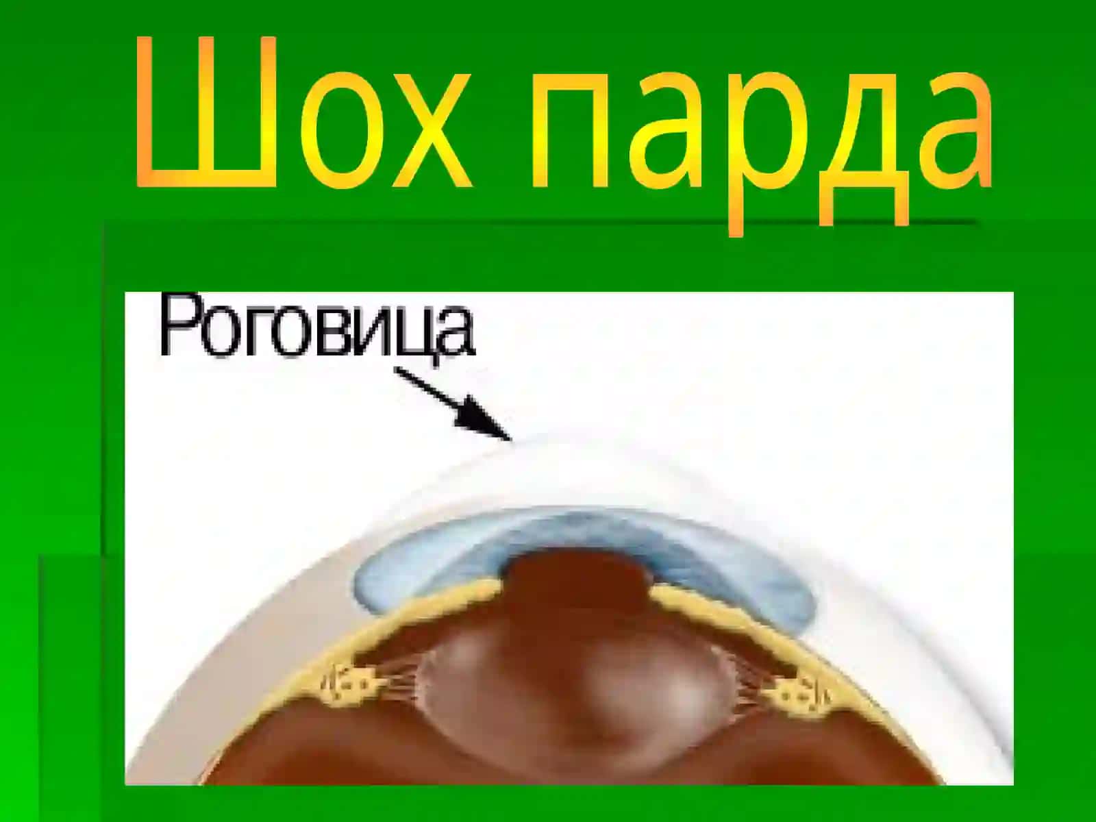 Шохпарда анатомияси 2