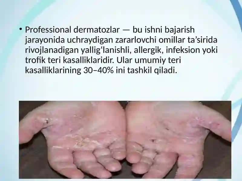 Professional dermatozlar 2
