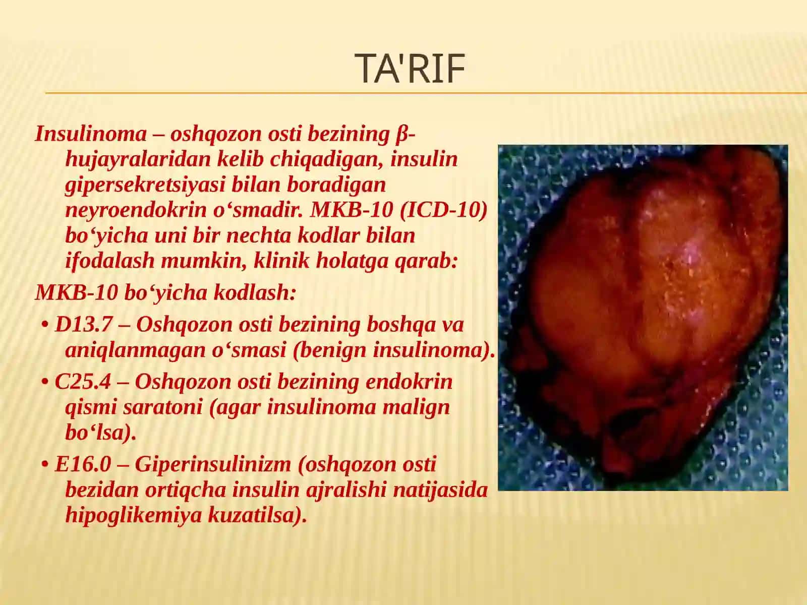 Insulinoma 2