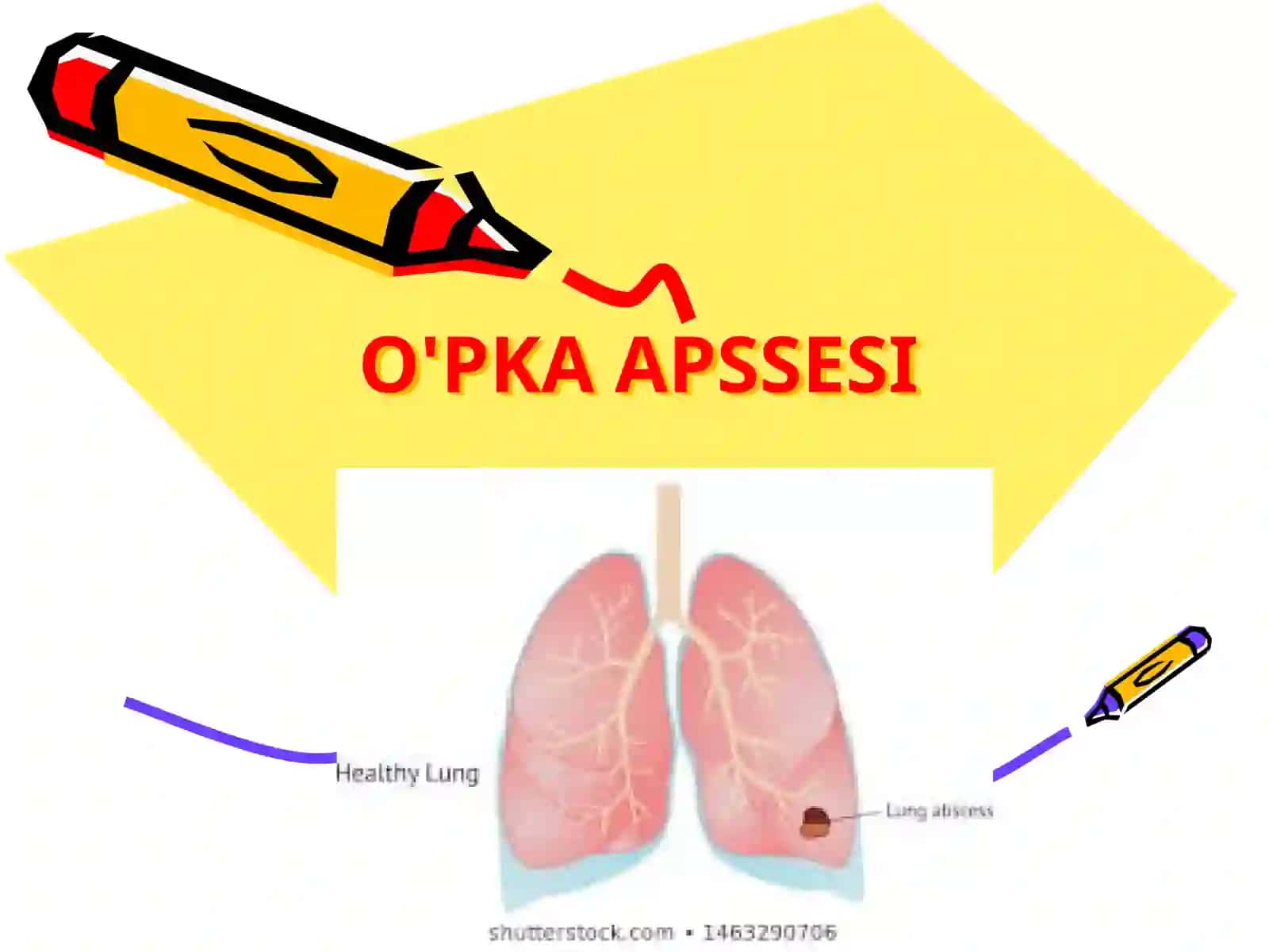 O'PKA APSSESI 2