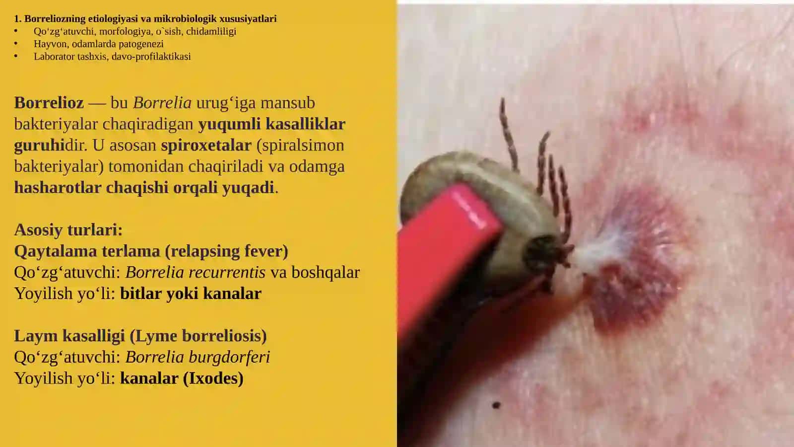 Borrelioz(Laymakasalligi).Leptospiralarmorfologiyasi,strukturasi,tarqalganligi,keltiribchiqaruvchikasalliklarivalaboratoriyatashhisi 2