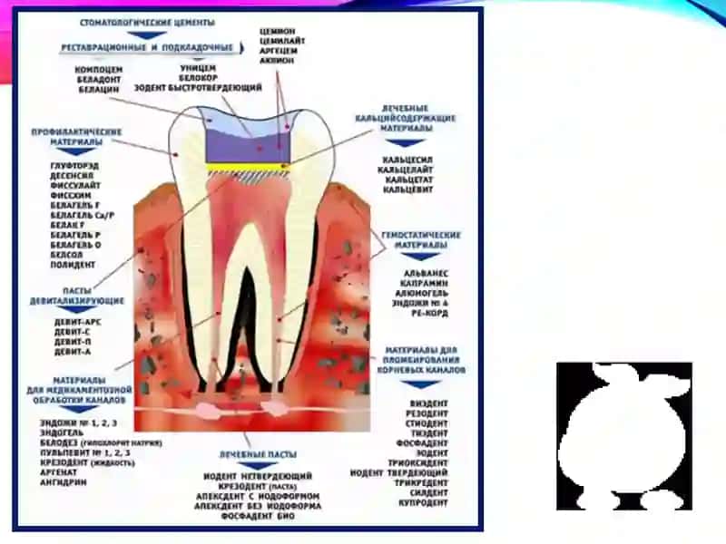 Stomatologiyada ishlatiladigan Plomba ashyolari PPTX 2