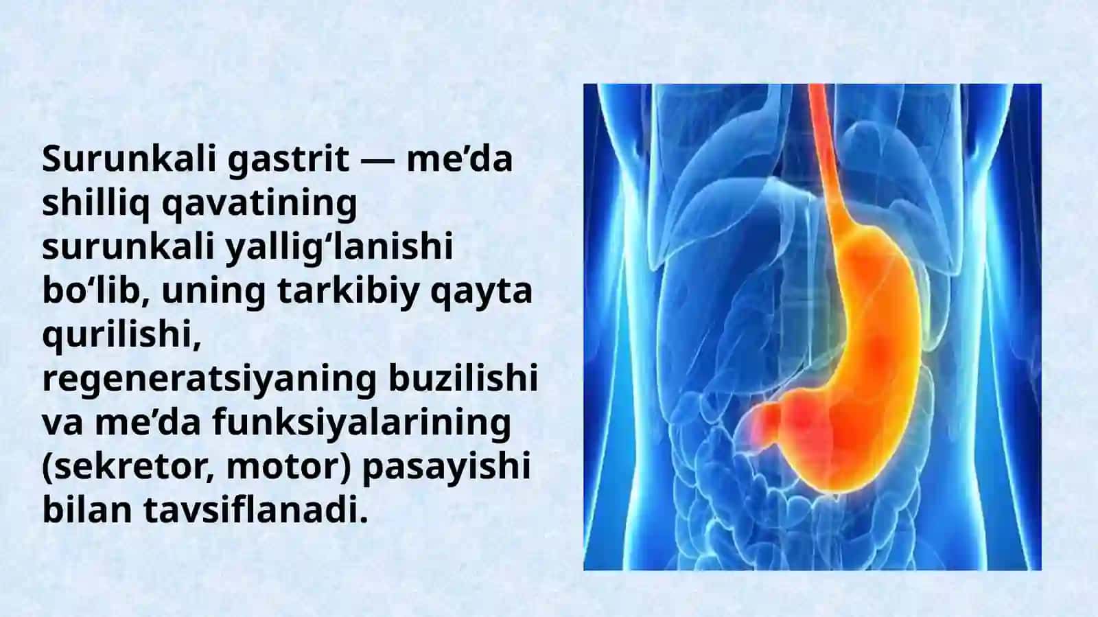 Surunkali gastrit turlari etiologiyasi patogenezi klinikasi asoratlari davolash usullari 2