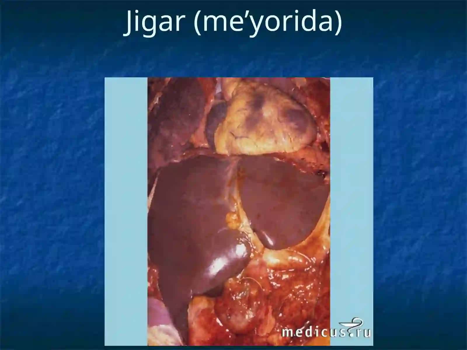 JIGAR SERROZI 2
