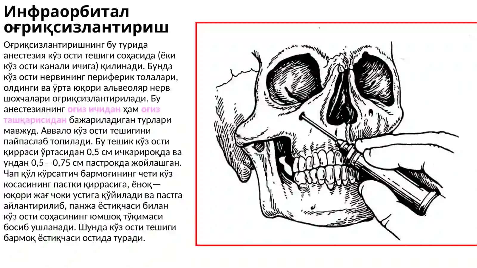 stomatologiyada og‘riqsizlantirishlar. infraorbital, insizival, palatinal. 2