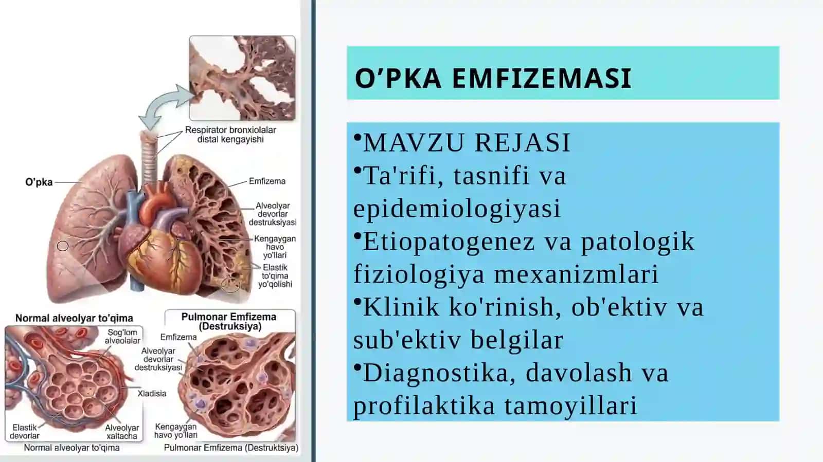 O’PKA EMFIZEMASI PREZENTATSIYA 2