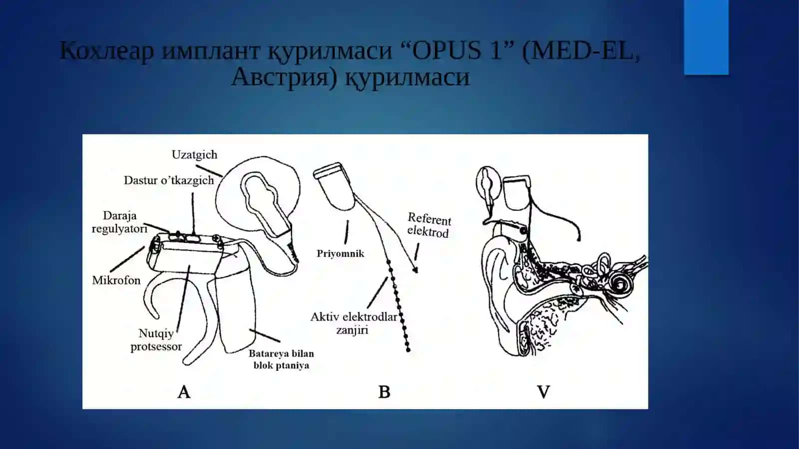 "OPUS 1" (MED-EL, Avstriya) 2