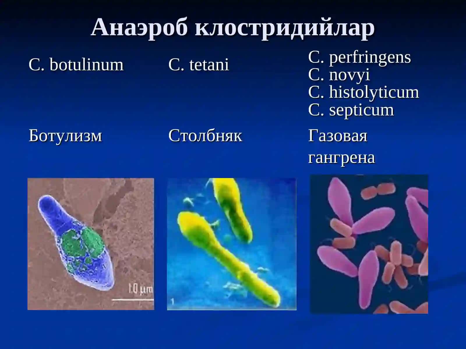 Жарохат инфекцияси.Кокшол, Газли гангрена 2