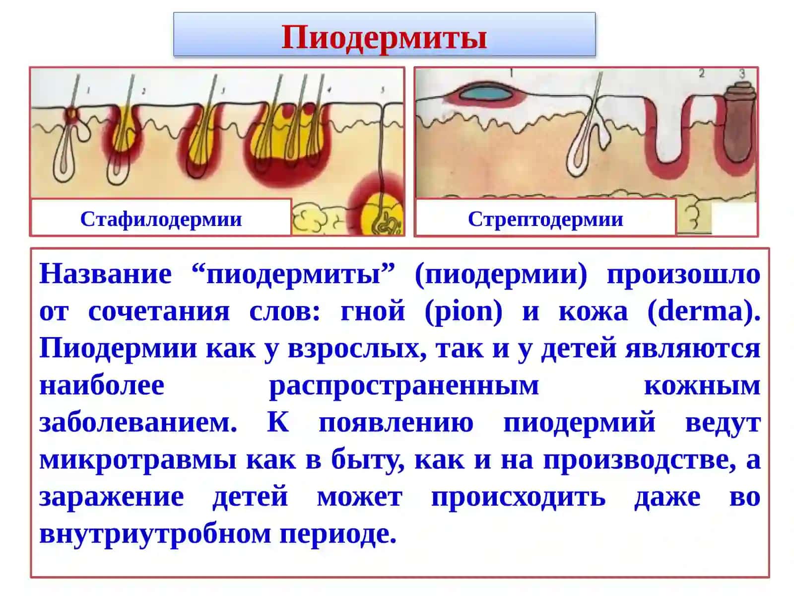 Пиодермии 2