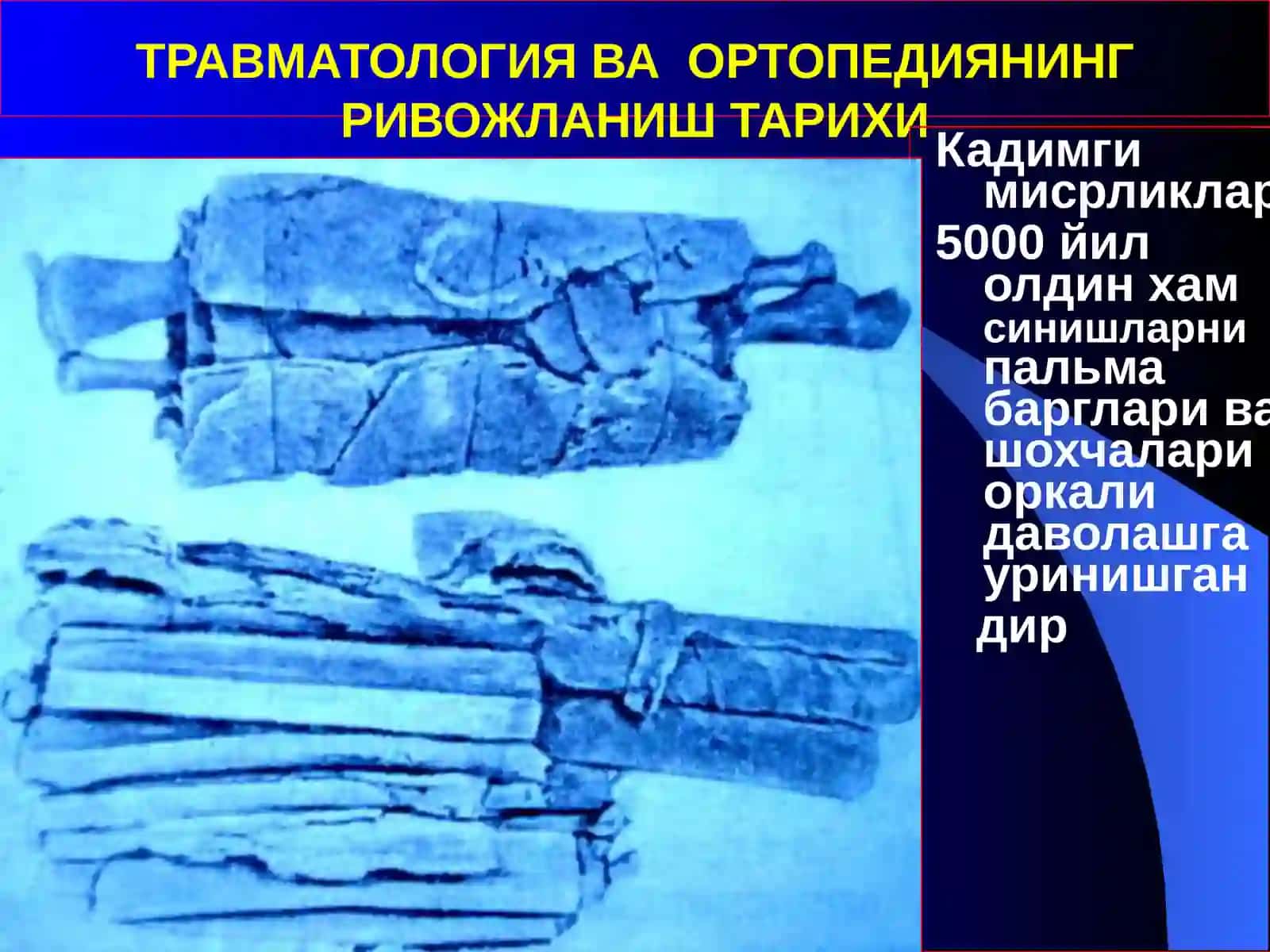 Травматология ва ортопедия кириш 2
