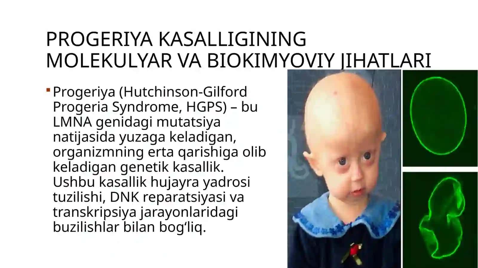 Progeriya kasalligining molekulyar va biokimyoviy jihatlari 2