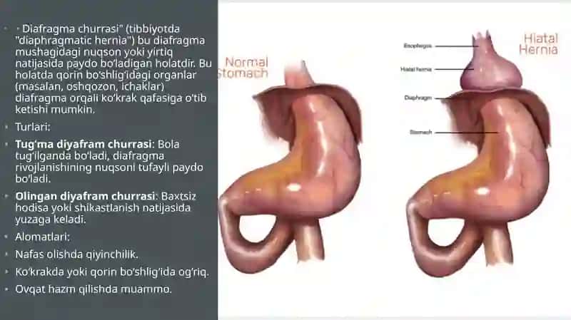 Diafragma churrasi 2