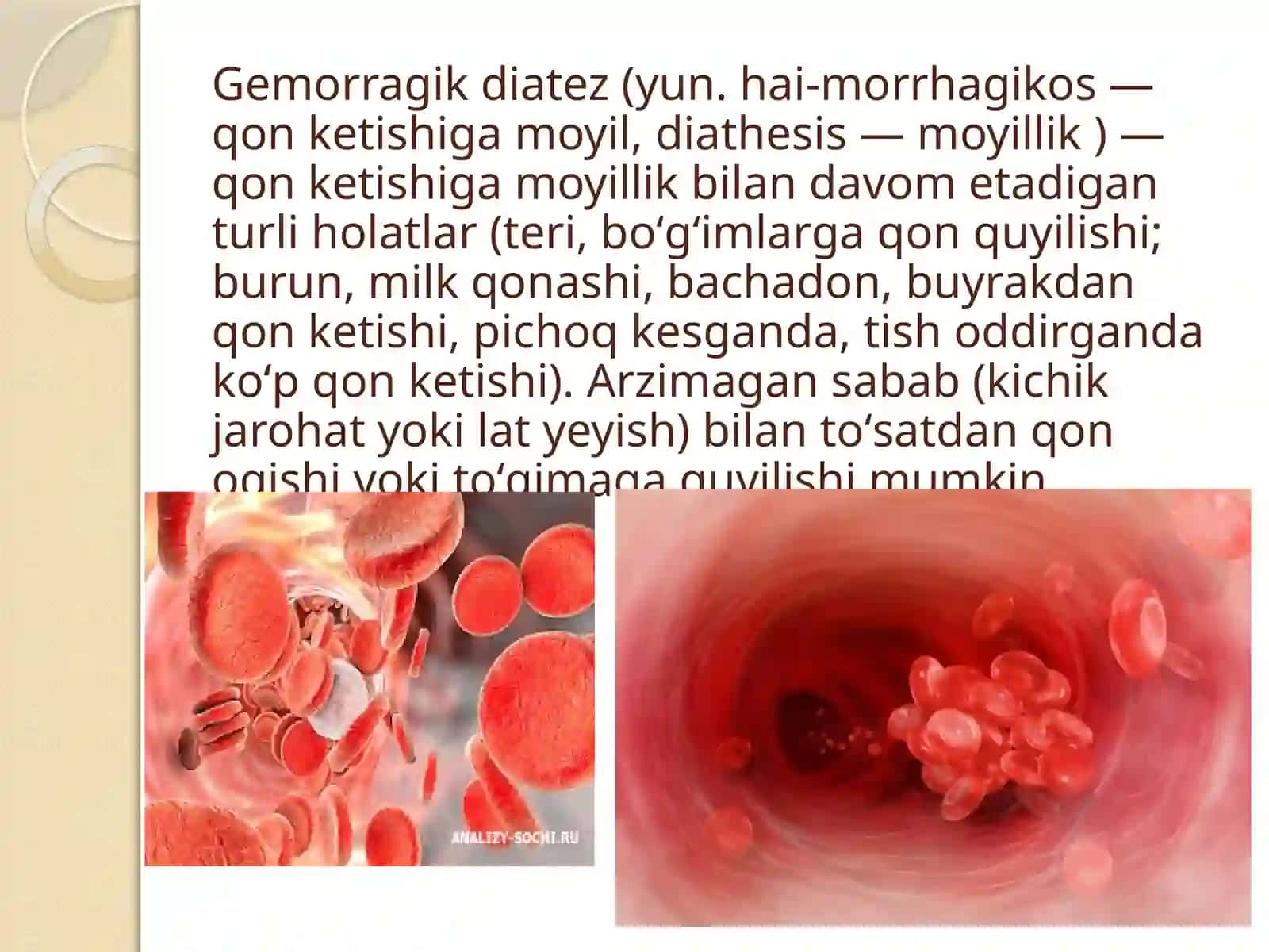 Gemorragikdiatezlarningko’rinishlari 2