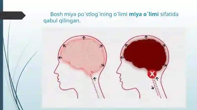Miyao`limining diagnostikasi 2