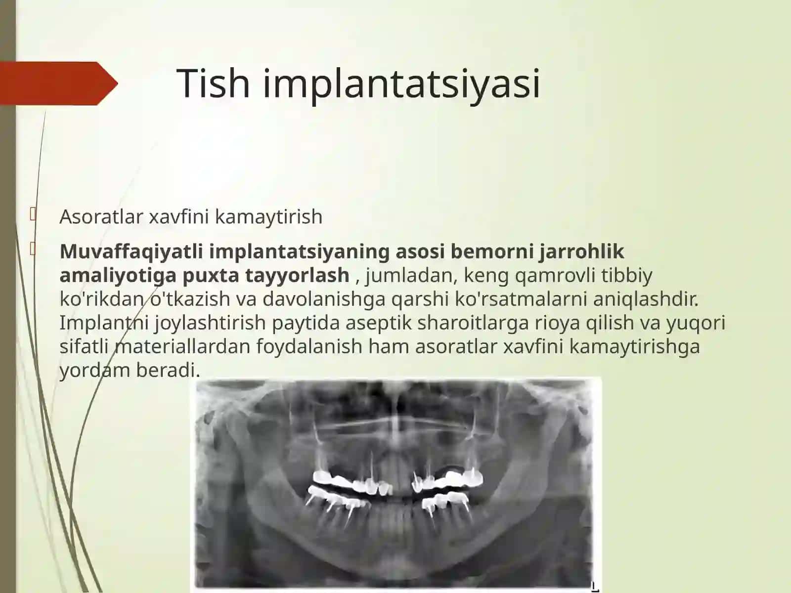 Implant bilan qo'llab-quvvatlanadigan protezlardan keyingi xatolar va asoratlar. Tish implant bilan qo'llab-quvvatlanadigan ortopedik tuzilmalarga ega bo'lganlar uchun og'iz gigienasi choralari . 2