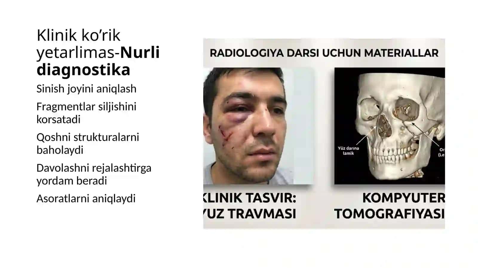Fragmentlarsiljishinikorsatadi 2