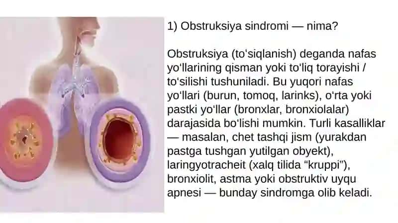 Obstruksiya sindromi 2