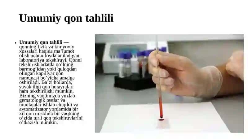 UMUMIY QON TAHLILINING INTERPRETATSIYASI 2