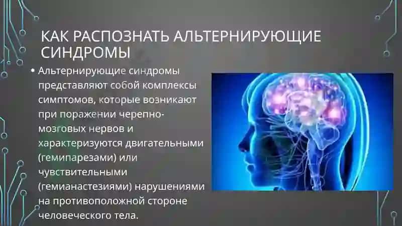 Альтернирующие синдромы 2
