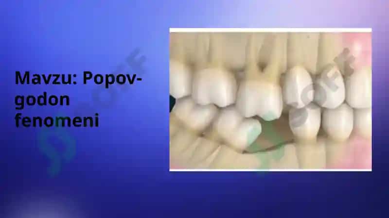 Popov-godon fenomeni 2