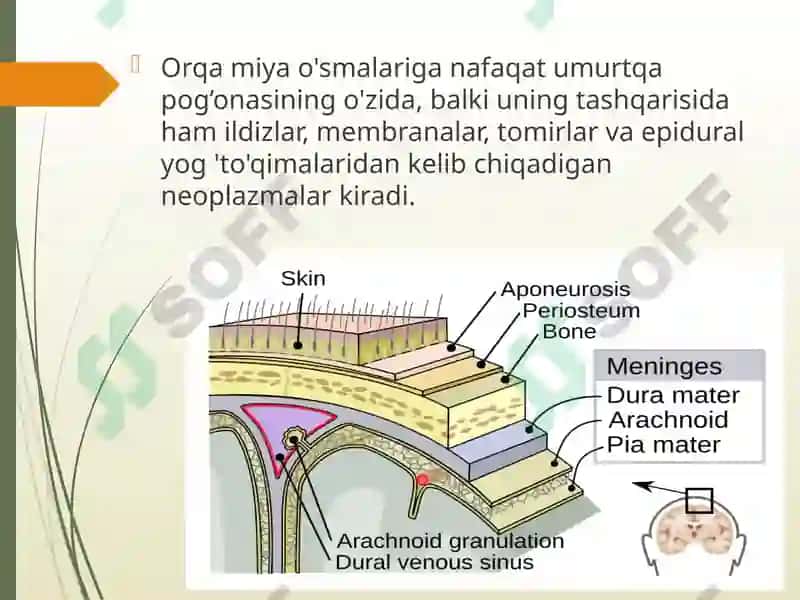 Orqa miya o’smalari 2