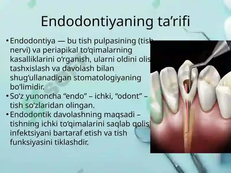 Endodontiya tushunchasi va davolash usullari 2
