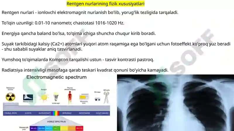 Rentgen_nurlarini_o'rganish_tarixi,_suyak_va_bo'g'imlar_rivojlanishini 2
