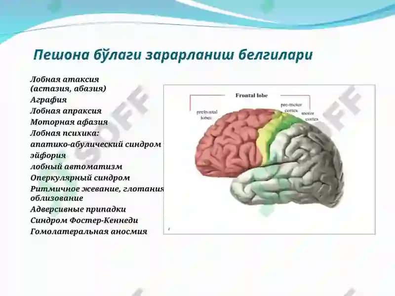 Бош мия ўsmалари 2