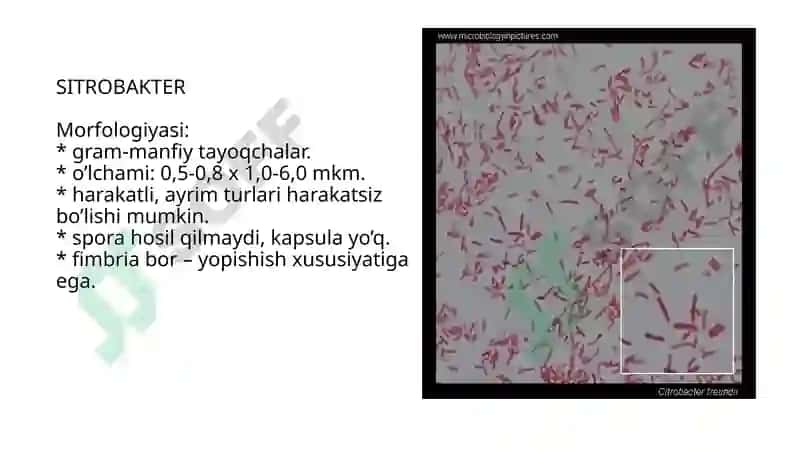Shartli patogen dioriyaogen ichak gruppa bakteriyalari Sitrobakter, Klebsiella, Enterobakter 2