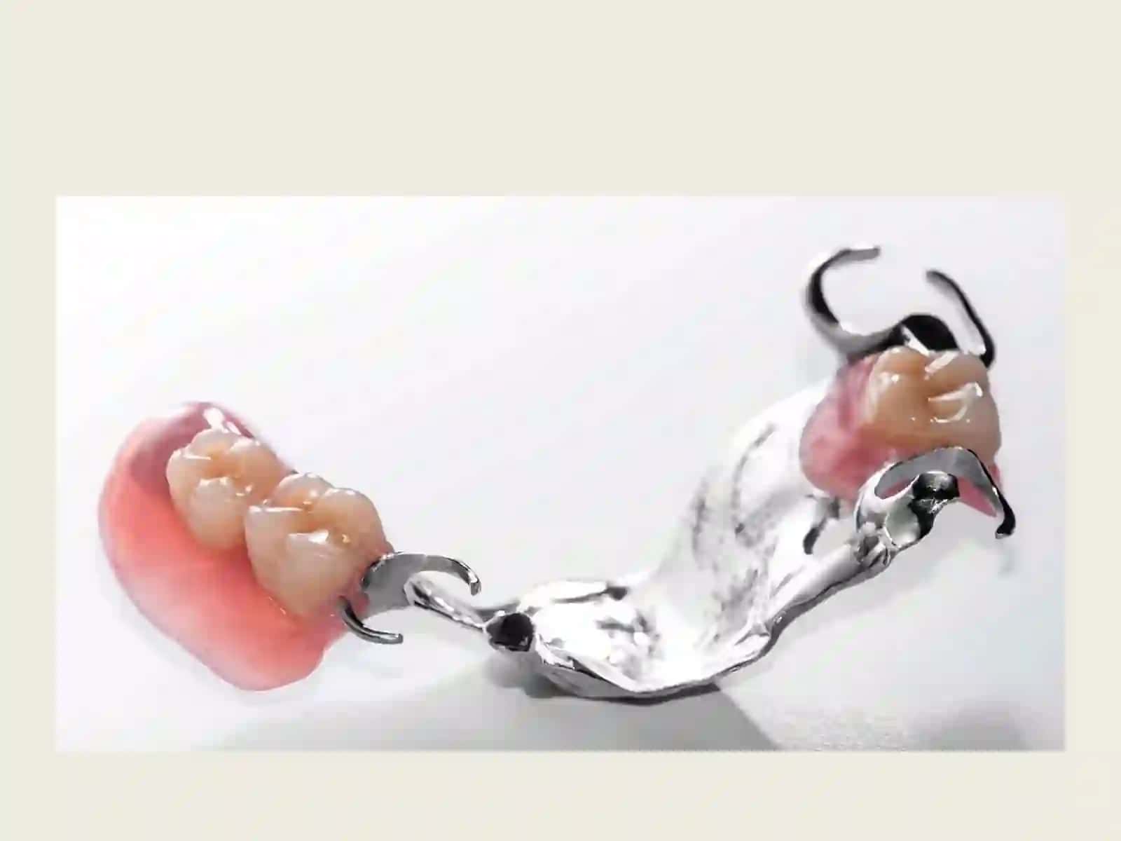 ORTAPEDIK STAOMATOLOGIYA AMALYOTIDA METAL QOTISH MALARDAN FOYDALANISH TISH PRATEZLARI 2