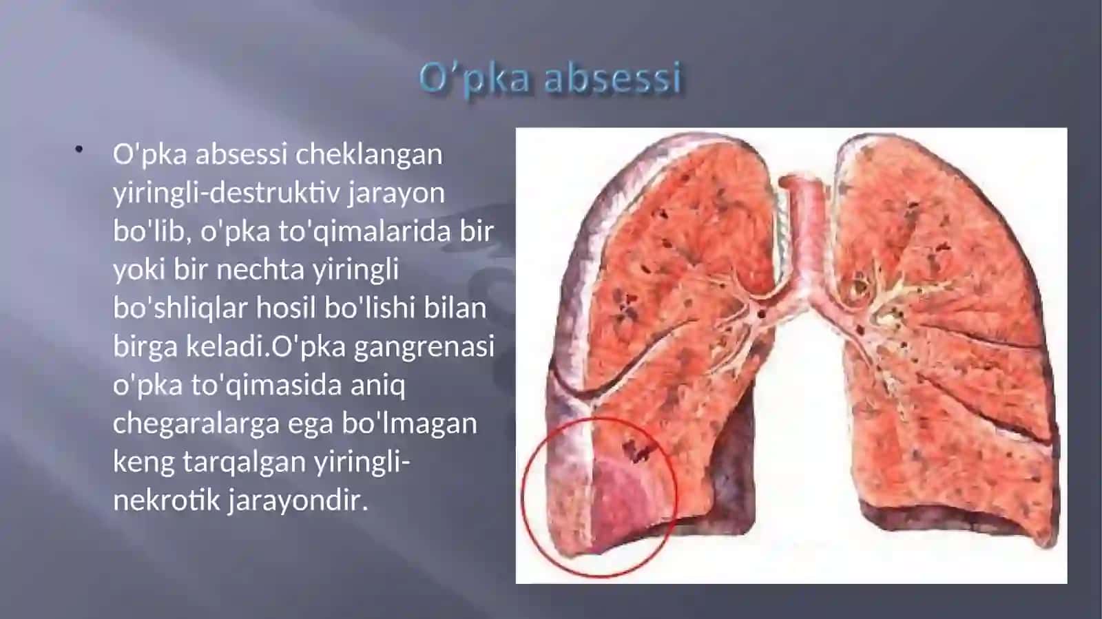 O’PKA ABSESSI 2