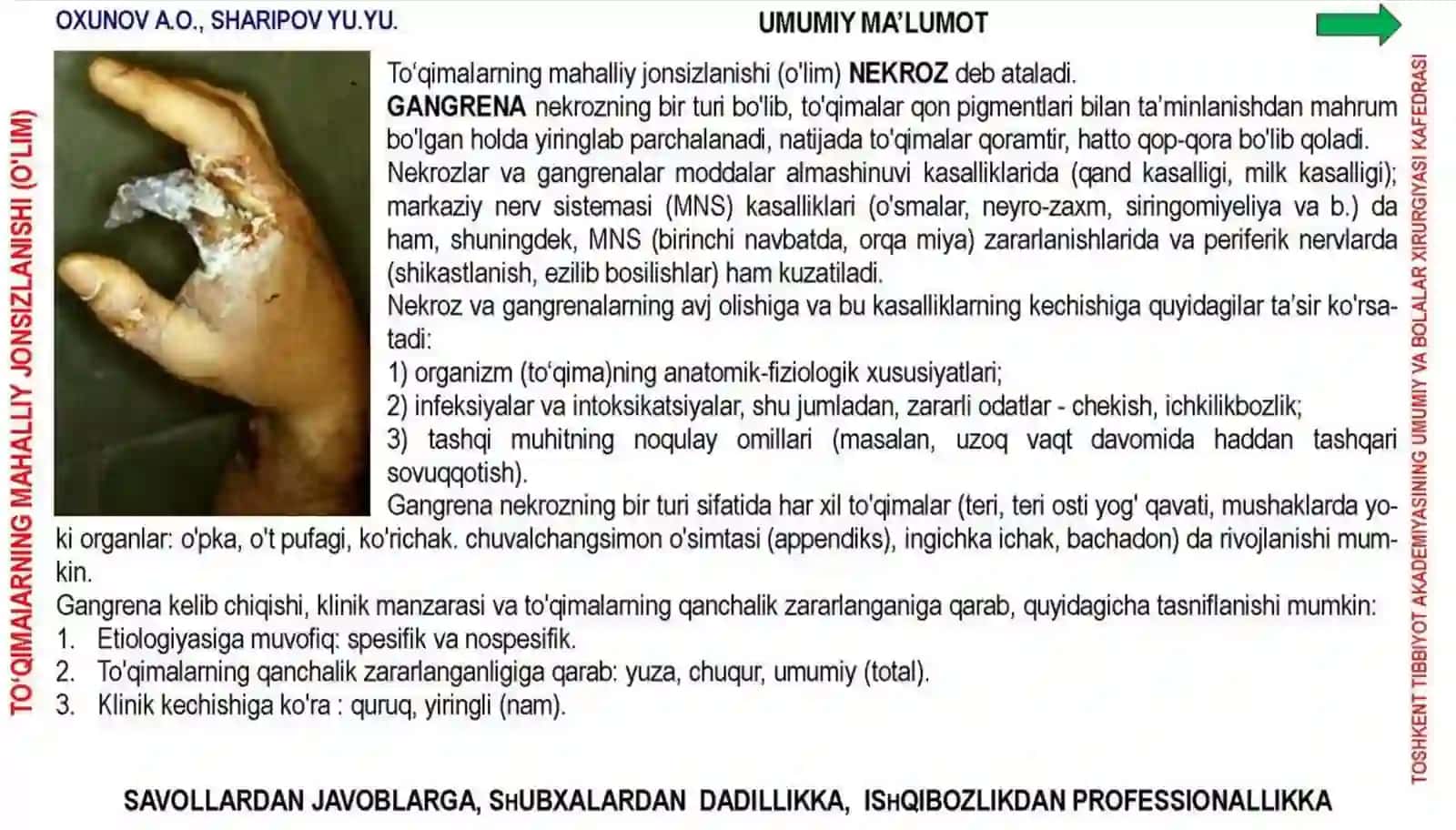 Qon Tomirlar Obliteratsiyalanuvchi Kasalliklari 2