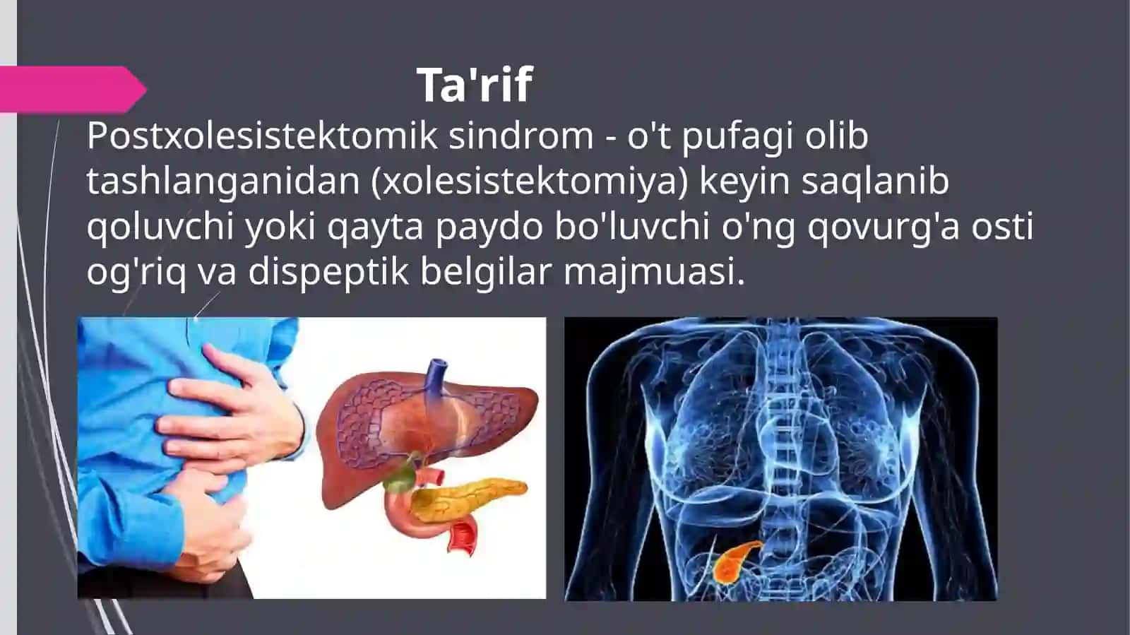 Postxolesistektomik sindromlar 2