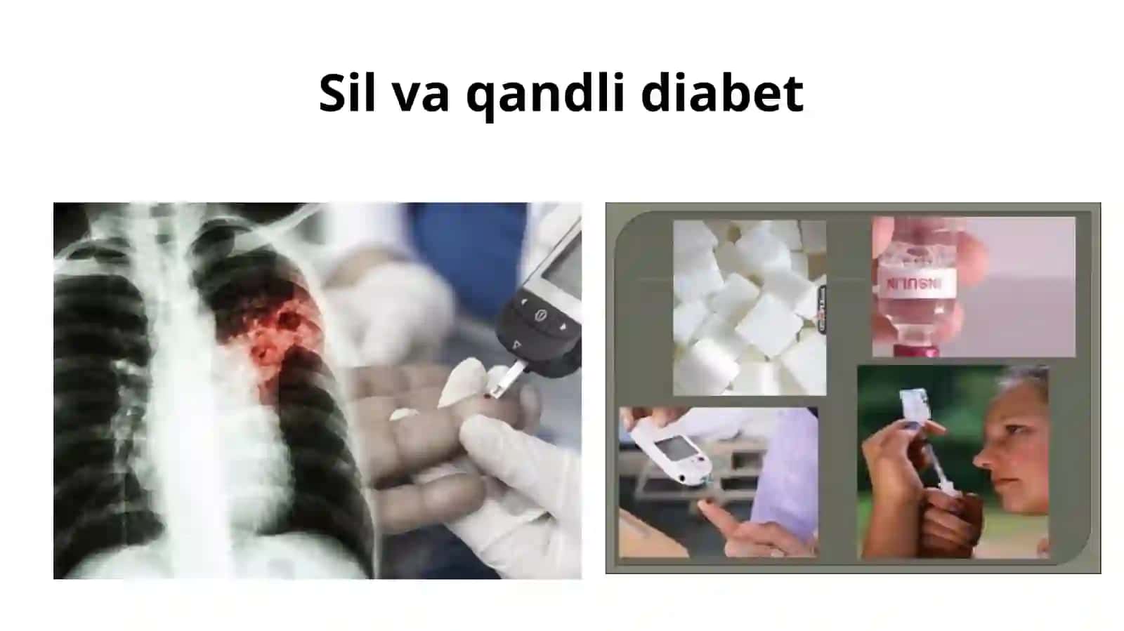 Silvaqandlidiabet 2