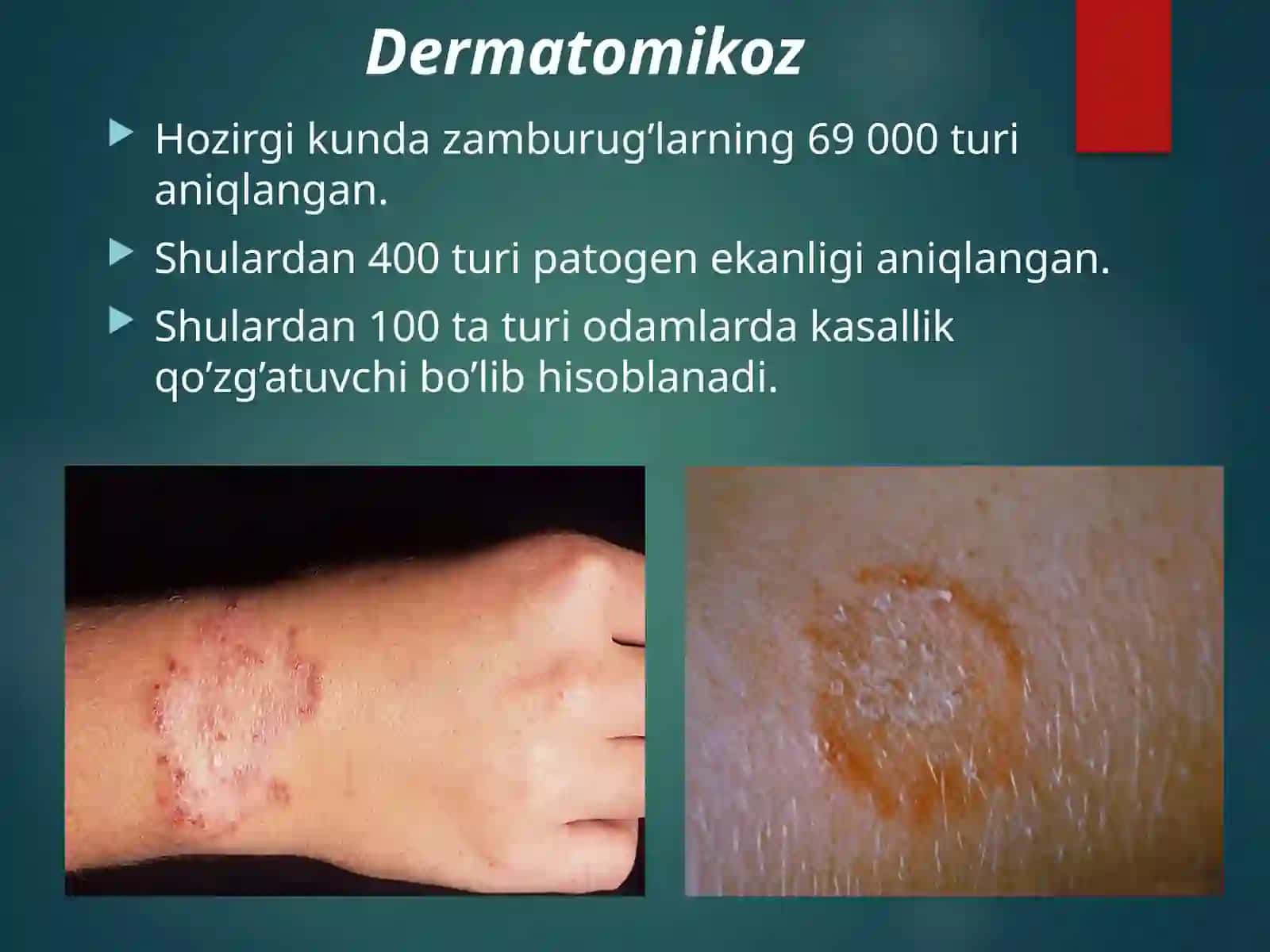 TERINING ZAMBURUG’LI KASALLIKLARI 2