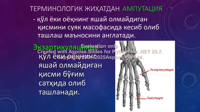 Ампутация ва экзартикуляция 2