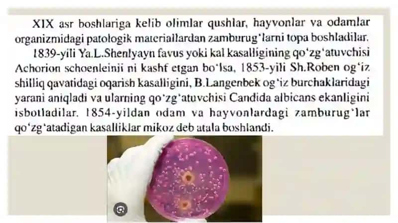 Zamburugʻlar keltirib chiqaruvchi kasalliklar (yuza va chuqur mikoz qoʻzgʻatuvchilar)labaratoriya tashxisi 2