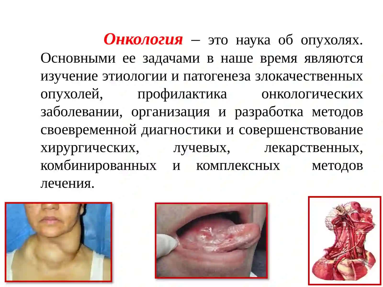 ЛЕКЦИЯ НА ТЕМУ: Злокачественные опухоли кожи лица, красной каймы губ и слизистой полости рта 2