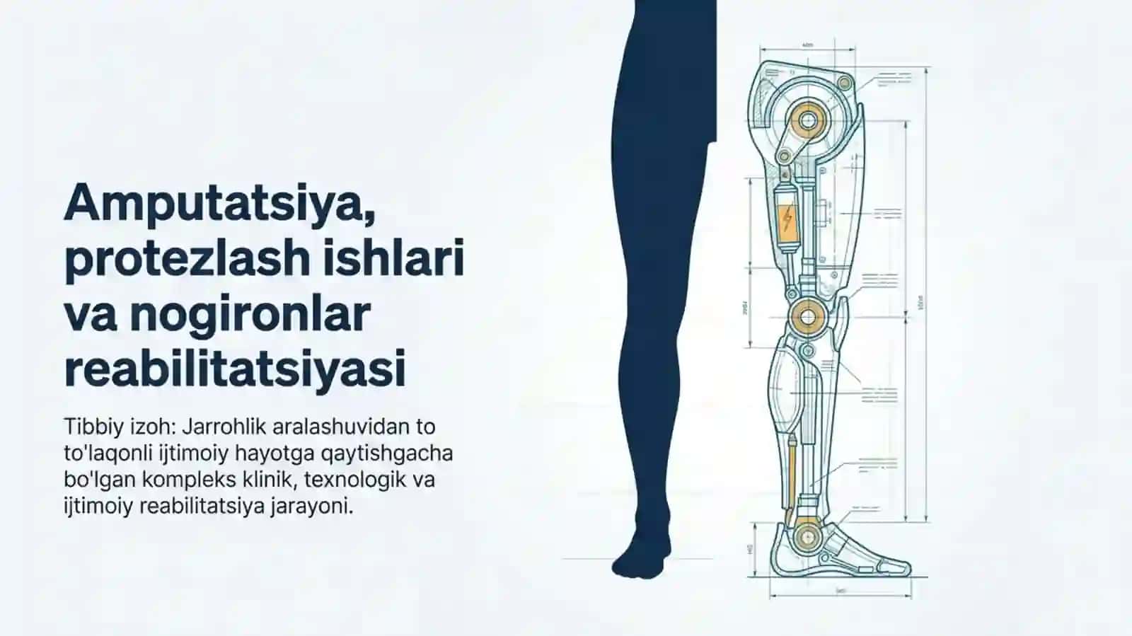Amputatsiya, protezlashishlar va nogironlar reabilitatsiyasi 3