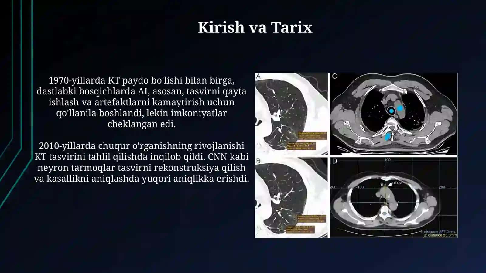 Kompyuter tamografiyasida sunʼiy intellekt 3
