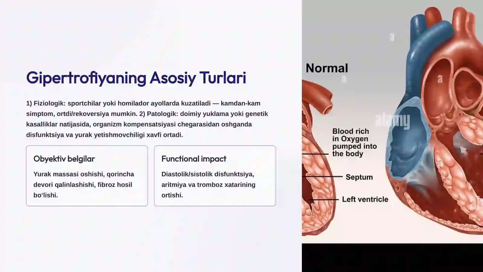 Miokard Gipertrofiyasi: Turlari, Mexanizmlari va Klinik Ahamiyati 3
