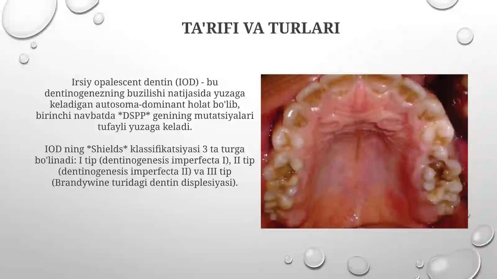 Irsiy tugallanmagan dentinogenez 3