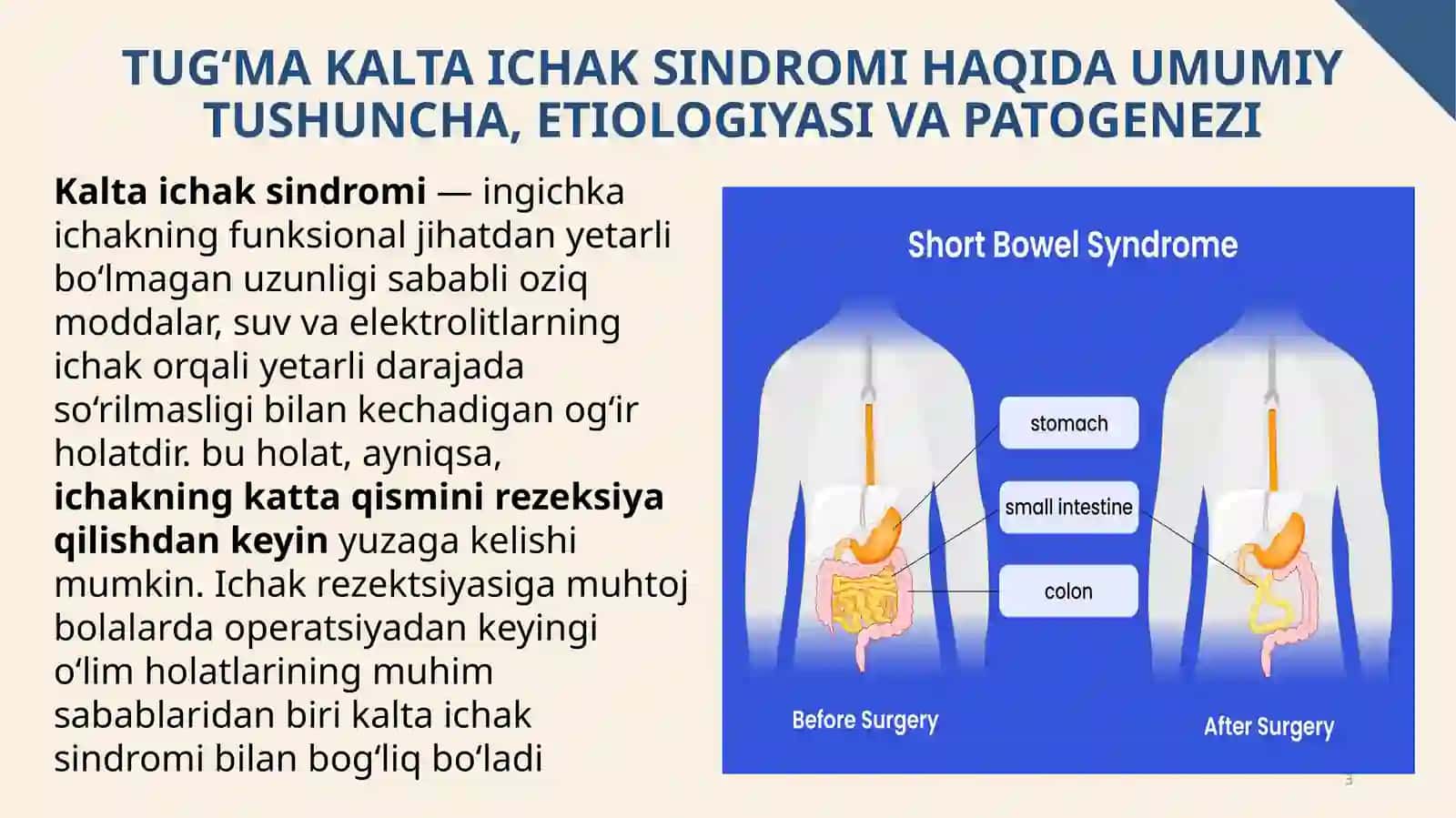Tug‘ma kalta ichak sindromi 3