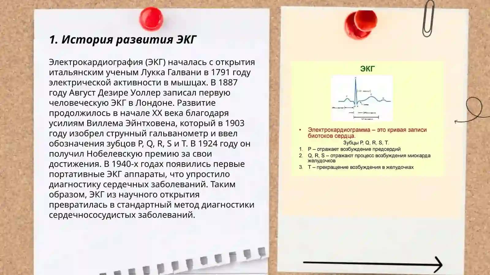ЭКГ 3